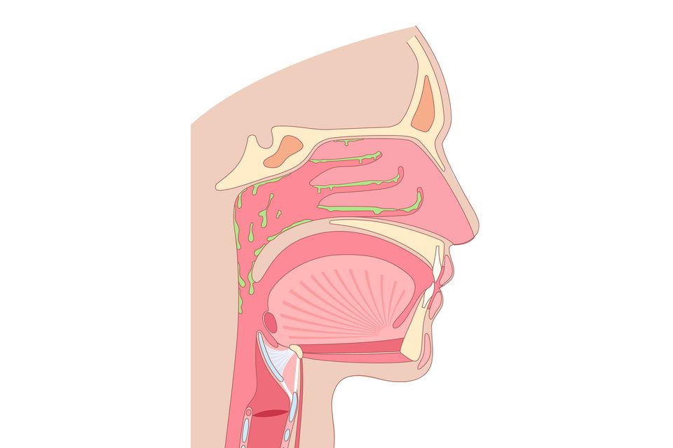 A post-nasal drip can really disrupt your sleep and your health. Photo: Getty